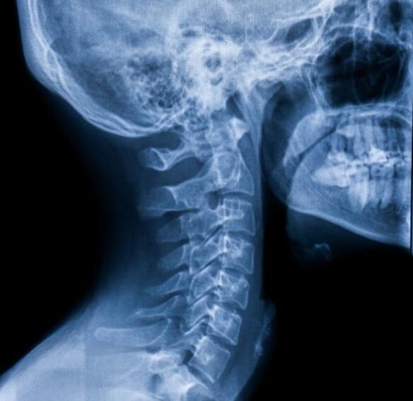 gxray rendgeni gamoZaxebit რენდგენი გამოძახებით